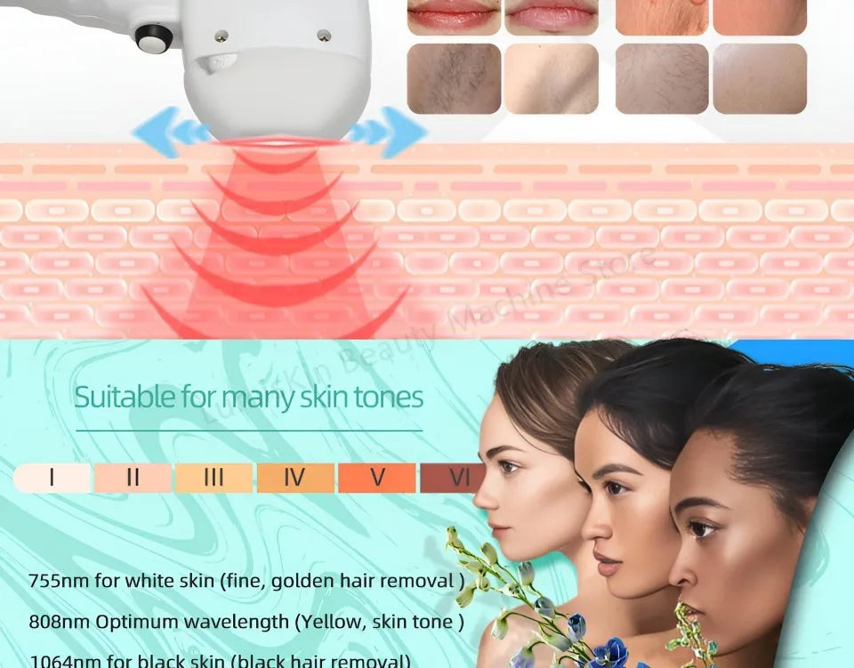 Painless Diode Laser Hair Removal Machine 755nm/808nm/940nm/1064nm 600W-1600W 60M Shots CE Certified For All Skin Types I-VI - Daisan Mart
