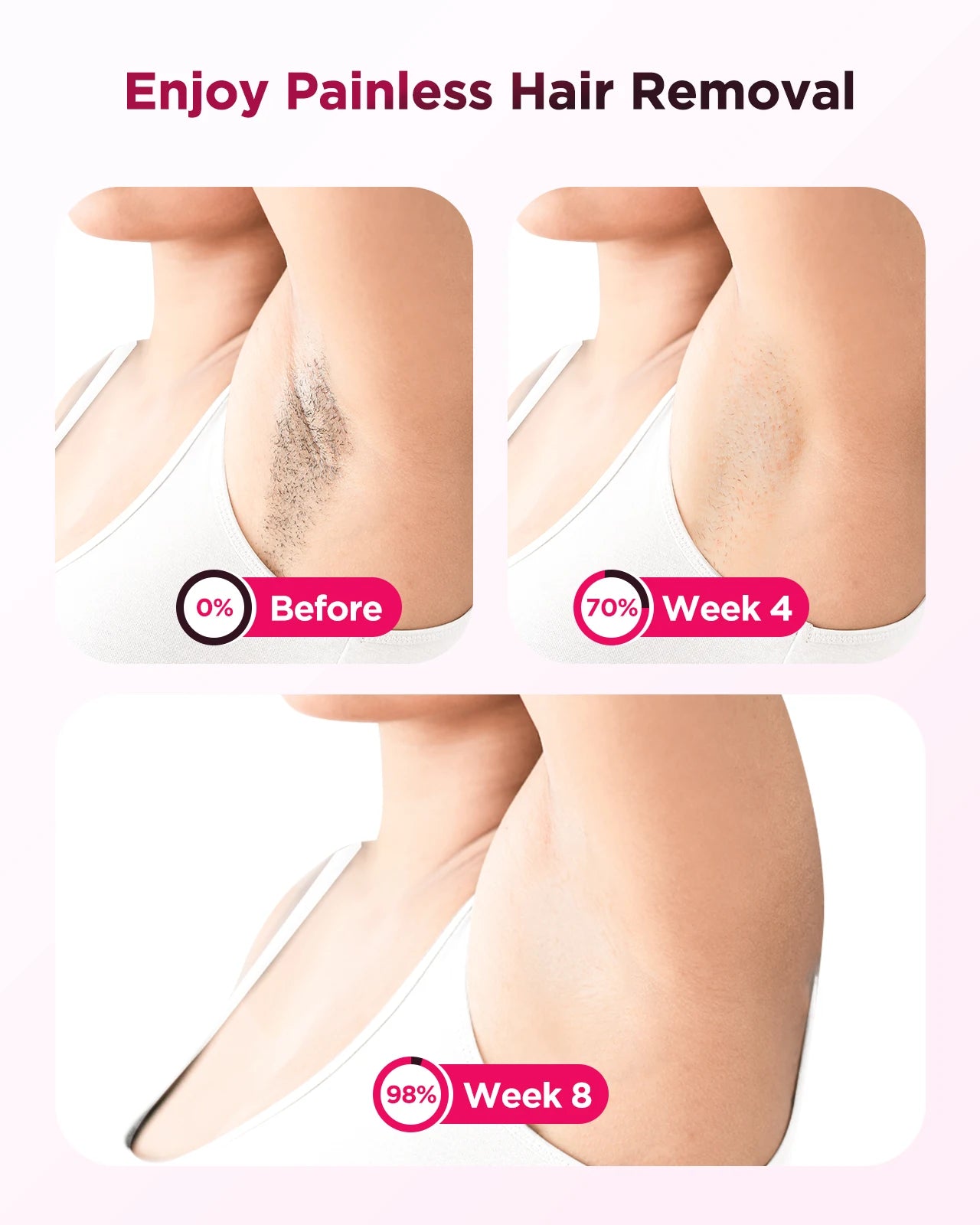 Máy Triệt Lông IPL Vĩnh Viễn - Dành Cho Nam Nữ - Daisan Mart
