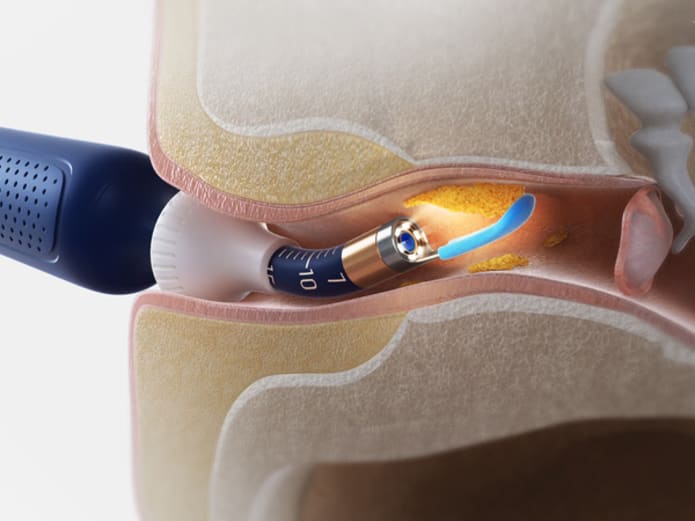 Bebird I35R - Wireless HD Ear Cleaning Headphones